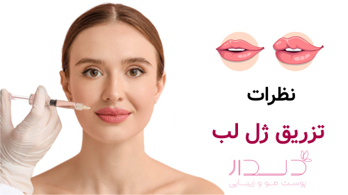 نظرات تزریق ژل لب