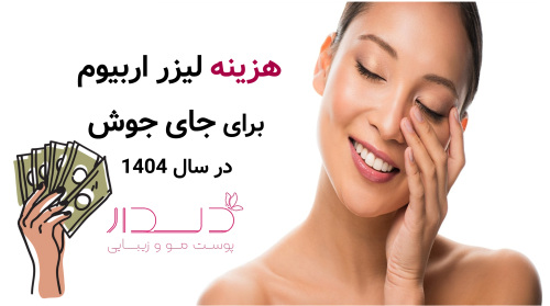 هزینه لیزر اربیوم برای جای جوش در سال 1404