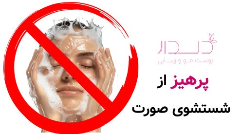 پرهیز از شستشوی صورت