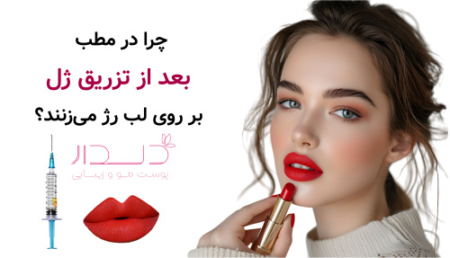 چرا در مطب بعد از تزریق ژل، بر روی لب رژ می‌زنند؟