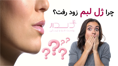 چرا ژل لبم زود رفت؟