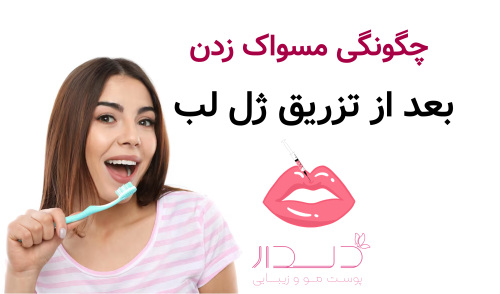 چگونگی مسواک زدن پس از تزریق ژل لب 