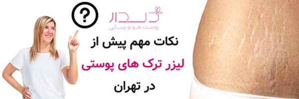 نکات مهم پیش از لیزر ترک های پوستی در تهران