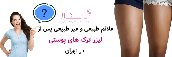 علائم طبیعی و غیر طبیعی پس از لیزر ترک های پوستی در تهران