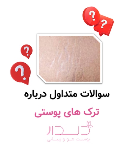 سوالات متداول درباره ترک های پوستی
