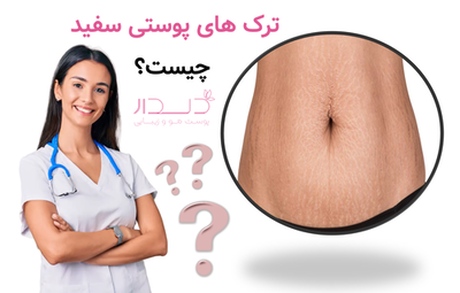 ترک های پوستی سفید چیست؟