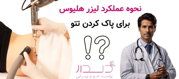 نحوه عملکرد لیزر هلیوس برای پاک کردن تتو