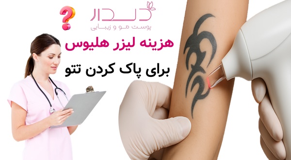 هزینه لیزر هلیوس برای پاک کردن تتو