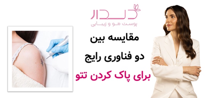 مقایسه بین دو فناوری رایج برای پاک کردن تتو