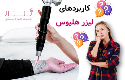 کاربردهای لیزر هلیوس