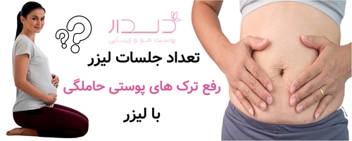 تعداد جلسات لیزر رفع ترک های پوستی حاملگی با لیزر